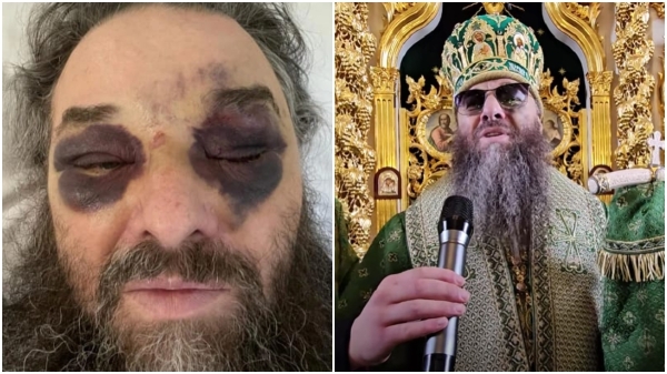 Romanian Orthodox Bishop Beaten and Hospitalized by Ukrainians, his House also Burned Down